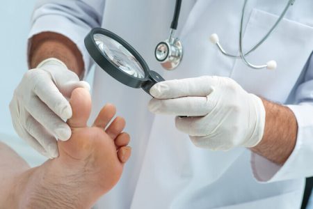 what causes toenail fungus