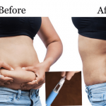 lose weight on ozempic